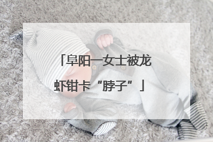 阜阳一女士被龙虾钳卡“脖子”